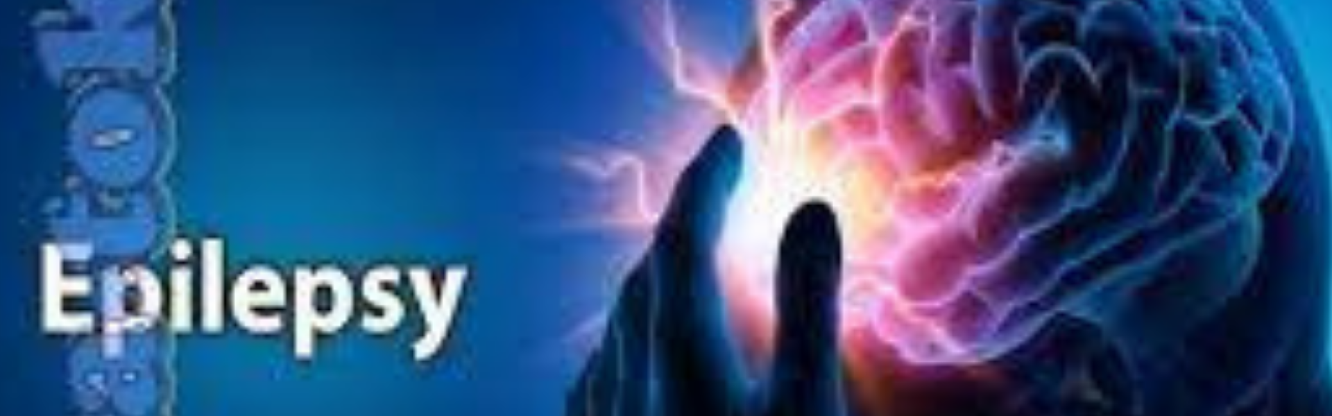  تعرف على علاج الصرع في الهند علاجات متقدمة